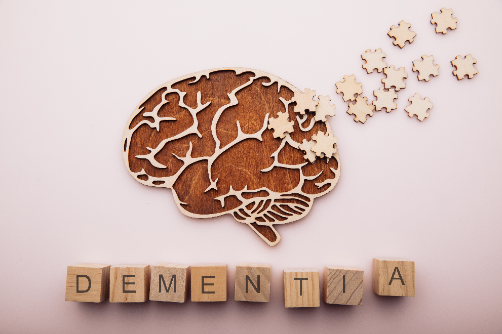 Brain with puzzle pieces and scrabble letters that spell out dementia